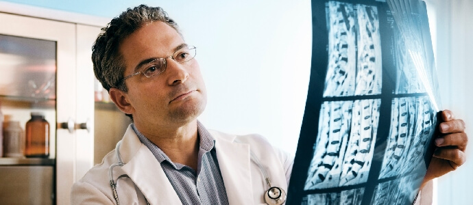 doctor looking at spine xrays